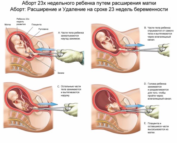 Скриншот 1 [Агитационный материал] ДЕТОУБИЙСТВО (АБОРТ) = УБИЙСТВО !!! [80 картинок] [450х251 - 1600x1200] JPG